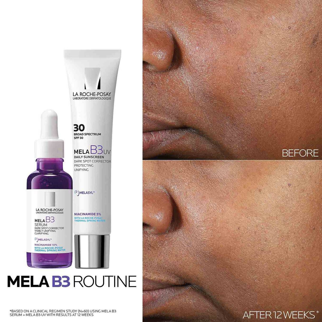 Mela B3 Dark Spot Serum & Mela B3 UV Daily Moisturizer With SPF 30